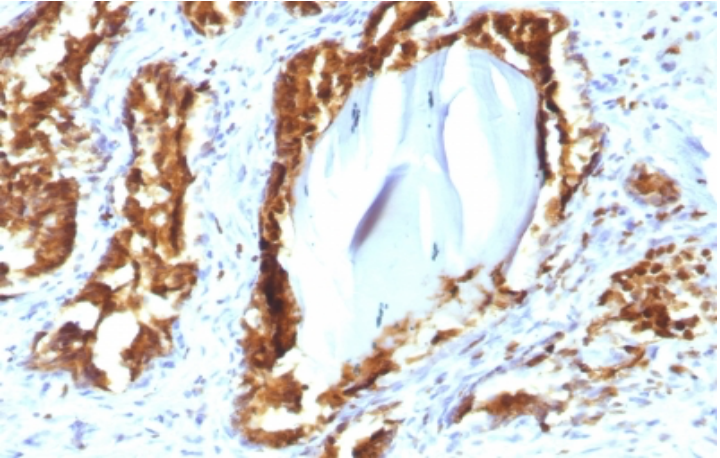 ACPP重组单克隆抗体IHC图片