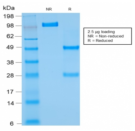 BCL2重组单克隆抗体SDS-PAGE评估
