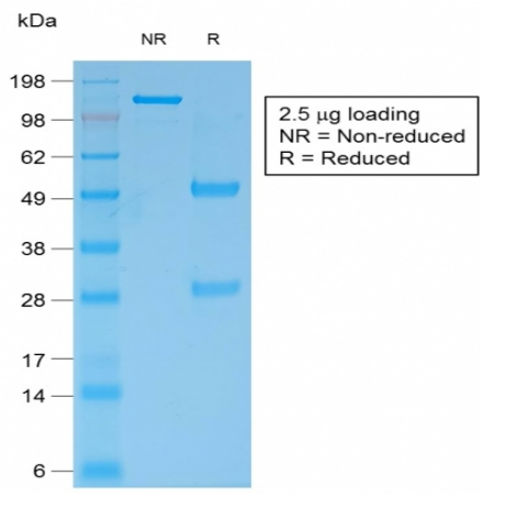 BCL2重组单克隆抗体SDS-PAGE