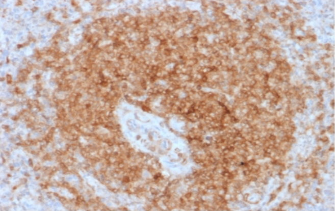 CD79a重组单克隆抗体IHC图