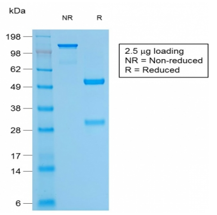CD79a重组单克隆抗体SDS-PAGE