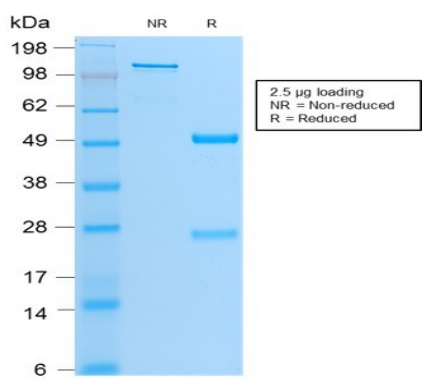 MyoD1重组单抗SDS-PAGE分析