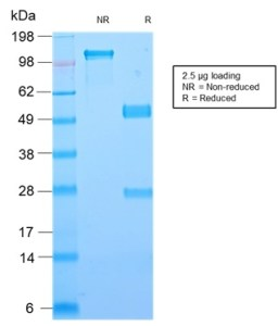 Galectin-1重组单抗SDS-PAGE分析