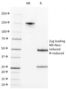 CD21单抗SDS-PAGE分析